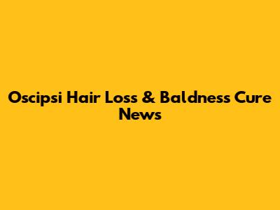 Oscipsi Hair Loss & Baldness Cure News