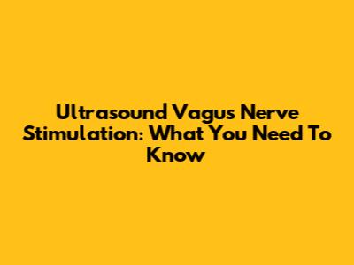 Ultrasound Vagus Nerve Stimulation: What You Need To Know